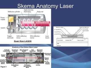 Skema Anatomy Laser 
4 
 