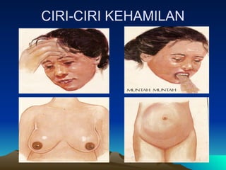 CIRI-CIRI KEHAMILAN
 