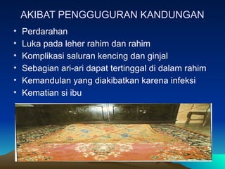 AKIBAT PENGGUGURAN KANDUNGAN
• Perdarahan
• Luka pada leher rahim dan rahim
• Komplikasi saluran kencing dan ginjal
• Sebagian ari-ari dapat tertinggal di dalam rahim
• Kemandulan yang diakibatkan karena infeksi
• Kematian si ibu
 