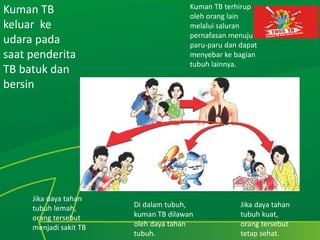 Kuman TB
keluar ke
udara pada
saat penderita
TB batuk dan
bersin
Kuman TB terhirup
oleh orang lain
melalui saluran
pernafasan menuju
paru-paru dan dapat
menyebar ke bagian
tubuh lainnya.
Jika daya tahan
tubuh kuat,
orang tersebut
tetap sehat.
Di dalam tubuh,
kuman TB dilawan
oleh daya tahan
tubuh.
Jika daya tahan
tubuh lemah,
orang tersebut
menjadi sakit TB
 