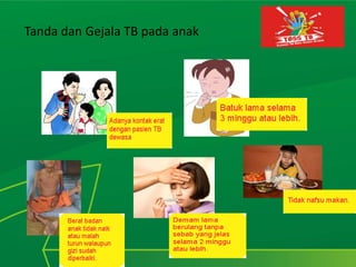 Tanda dan Gejala TB pada anak
 