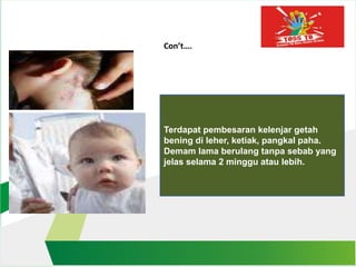 Con’t….
Terdapat pembesaran kelenjar getah
bening di leher, ketiak, pangkal paha.
Demam lama berulang tanpa sebab yang
jelas selama 2 minggu atau lebih.
 