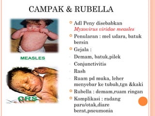 Campak Rash MATERI SOSIALISASI PD3i UPTD PUSKESMAS SOLO.ppt