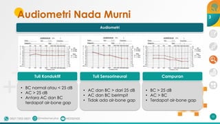Audiometri Nada Murni
10
3
• BC normal atau < 25 dB
• AC > 25 dB
• Antara AC dan BC
terdapat air-bone gap
• AC dan BC > dari 25 dB
• AC dan BC berimpit
• Tidak ada air-bone gap
• BC > 25 dB
• AC > BC
• Terdapat air-bone gap
Tuli Konduktif Tuli Sensorineural Campuran
Audiometri
 
