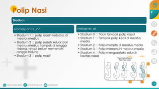 Polip Nasi
Mackay and Lund
• Stadium 1 🡪 polip masih terbatas di
meatus medius
• Stadium 2 🡪 polip sudah keluar dari
meatus medius, tampak di rongga
hidung, tetapi belum memenuhi
rongga hidung
• Stadium 3 🡪 polip masif
145
Meltzer et. al.
• Stadium 0 🡪 Tidak tampak polip nasal
• Stadium 1 🡪 Tampak polip kecil di meatus
media
• Stadium 2 🡪 Polip multiple di meatus media
• Stadium 3 🡪 Polip memenuhi meatus media
• Stadium 4 🡪 Polip mengobstuksi seluruh
kavitas nasal
2
Stadium
 