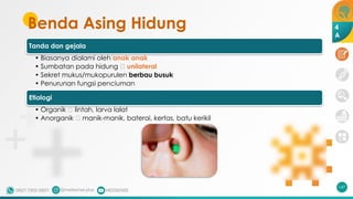 Benda Asing Hidung
Tanda dan gejala
• Biasanya dialami oleh anak anak
• Sumbatan pada hidung 🡪 unilateral
• Sekret mukus/mukopurulen berbau busuk
• Penurunan fungsi penciuman
Etiologi
• Organik 🡪 lintah, larva lalat
• Anorganik 🡪 manik-manik, baterai, kertas, batu kerikil
147
4
A
 