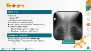 Laringitis
Gejala Klinis
• Demam
• Gejala ISPA
• Nyeri menelan (odinofagia)
• Kesulitan menelan (disfagia)
• Suara serak (disfonia)/suara hilang (afonia)
• Pada keadaan kronis:
•• Rasa mengganjal di tenggorokan
•• Rasa ingin berdehem lebih sering
Pemeriksaan Penunjang
• Foto thorax 🡪 gambaran steeple sign
• Laringoskopi 🡪 laring eritema dan edema
182
Steeple sign
4
A
 