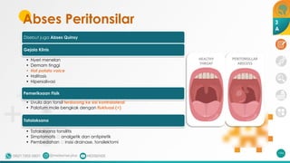 Abses Peritonsilar
Disebut juga Abses Quinsy
Gejala Klinis
• Nyeri menelan
• Demam tinggi
• Hot potato voice
• Halitosis
• Hipersalivasi
Pemeriksaan Fisik
• Uvula dan tonsil terdorong ke sisi kontralateral
• Palatum mole bengkak dengan fluktuasi (+)
Tatalaksana
• Tatalaksana tonsilitis
• Simptomatis 🡪 analgetik dan antipiretik
• Pembedahan 🡪 insisi drainase, tonsilektomi
194
3
A
 