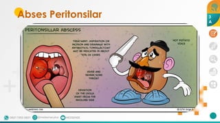 Abses Peritonsilar 3
A
 