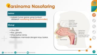 Karsinoma Nasofaring
Definisi
• Adalah tumor ganas yang tumbuh
didaerah nasofaring (fossa Rossenmuller)
Etiologi
• Virus EBV
• Ras, genetic
• Iritasi bahan kimia
• Kebiasaan memasak dengan kayu bakar.
198
 