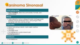 Karsinoma Sinonasal
Lokasi paling sering
• Sinus maxillaris, diikuti sinus etmoidalis, frontalis, dan
sphenoidalis
Etiologi
• Tidak diketahui namun didapati insiden tertinggi pada
pekerja industri perabotan kayu, penyulingan nikel,
pengrajin kulit atau pembuat gas.
Gejala Klinis
• Sekret bercampur darah, nyeri wajah, epifora
• Diplopia
• Obstruksi nasal
• Pembengkakan pada daerah pipi
• Buldging palatum
Tatalaksana
• Pembedahan
203
 