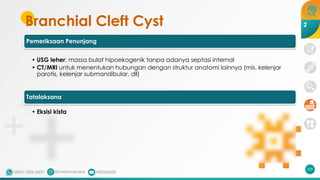 Branchial Cleft Cyst
Pemeriksaan Penunjang
• USG leher: massa bulat hipoekogenik tanpa adanya septasi internal
• CT/MRI untuk menentukan hubungan dengan struktur anatomi lainnya (mis. kelenjar
parotis, kelenjar submandibular, dll)
Tatalaksana
• Eksisi kista
209
2
 