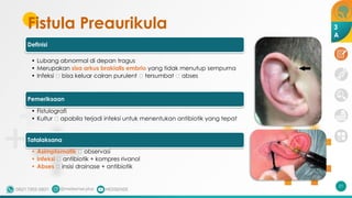 Fistula Preaurikula
Definisi
• Lubang abnormal di depan tragus
• Merupakan sisa arkus brakialis embrio yang tidak menutup sempurna
• Infeksi 🡪 bisa keluar cairan purulent 🡪 tersumbat 🡪 abses
Pemeriksaan
• Fistulografi
• Kultur 🡪 apabila terjadi infeksi untuk menentukan antibiotik yang tepat
Tatalaksana
• Asimptomatik 🡪 observasi
• Infeksi 🡪 antibiotik + kompres rivanol
• Abses 🡪 insisi drainase + antibiotik
21
3
A
 