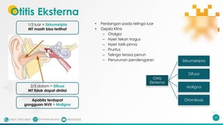 Otitis Eksterna
24
• Perdangan pada telinga luar
• Gejala Klinis
– Otalgia
– Nyeri tekan tragus
– Nyeri tarik pinna
– Pruritus
– Telinga terasa penuh
– Penurunan pendengaran
1/3 luar = Sirkumsripta
MT masih bisa terlihat
2/3 dalam = Difusa
MT tidak dapat dinilai
Apabila terdapat
gangguan NVII = Maligna
Otitis
Eksterna
Sirkumskripta
Difusa
Maligna
Otomikosis
 