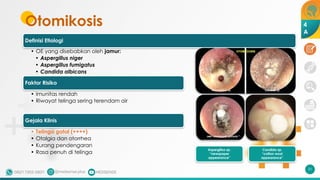 Otomikosis
31
Definisi Etiologi
• OE yang disebabkan oleh jamur:
• Aspergillus niger
• Aspergillus fumigatus
• Candida albicans
Faktor Risiko
• Imunitas rendah
• Riwayat telinga sering terendam air
Gejala Klinis
• Telinga gatal (++++)
• Otalgia dan otorrhea
• Kurang pendengaran
• Rasa penuh di telinga
Candida sp.
“cotton wool
appearance”
Aspergillus sp.
“newspaper
appearance”
4
A
 
