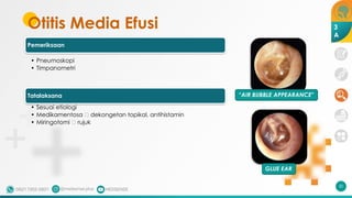 Otitis Media Efusi
Pemeriksaan
• Pneumoskopi
• Timpanometri
Tatalaksana
• Sesuai etiologi
• Medikamentosa 🡪 dekongetan topikal, antihistamin
• Miringotomi 🡪 rujuk
50
“AIR BUBBLE APPEARANCE"
GLUE EAR
3
A
 