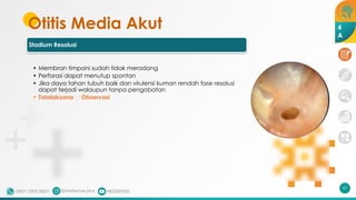 Otitis Media Akut
Stadium Resolusi
• Membran timpani sudah tidak meradang
• Perforasi dapat menutup spontan
• Jika daya tahan tubuh baik dan virulensi kuman rendah fase resolusi
dapat terjadi walaupun tanpa pengobatan
• Tatalaksana 🡪 Observasi
57
4
A
 