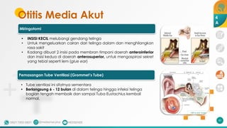 Otitis Media Akut
60
4
A
Miringotomi
• INSISI KECIL melubangi gendang telinga
• Untuk mengeluarkan cairan dari telinga dalam dan menghilangkan
rasa sakit
• Kadang dibuat 2 insisi pada membran timpani daerah anteroinferior
dan insisi kedua di daerah anterosuperior, untuk mengaspirasi sekret
yang tebal seperti lem (glue ear)
Pemasangan Tube Ventilasi (Grommet’s Tube)
• Tube ventilasi ini sifatnya sementara
• Berlangsung 6 - 12 bulan di dalam telinga hingga infeksi telinga
bagian tengah membaik dan sampai Tuba Eustachius kembali
normal.
 