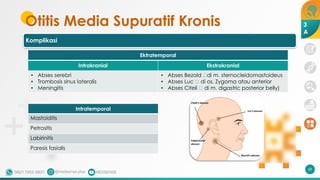 Otitis Media Supuratif Kronis
Intratemporal
Mastoiditis
Petrositis
Labirinitis
Paresis fasialis
68
Ektratemporal
Intrakranial Ekstrakranial
• Abses serebri
• Trombosis sinus lateralis
• Meningitis
• Abses Bezold 🡪di m. sternocleidomastoideus
• Abses Luc 🡪 di os. Zygoma atau anterior
• Abses Citeli 🡪 di m. digastric posterior belly)
3
A
Komplikasi
 