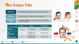 Tes Garpu Tala
• menilai air conduction dan bone conduction
RINNE TEST
• menilai bone conduction kanan dan kiri
WEBER TEST
• membandingkan bone conduction penderita
dan pemeriksa
SCHWABACH
TEST
Rinne Weber Schwabach
Normal (+) (-) lateralisasi
Sama dengan
pemeriksa
Tuli
Konduktif
(-)
Lateralisasi ke
telinga sakit
Memanjang
Tuli
Sensorineural
(+)
Lateralisasi ke
telinga sehat
Memendek
8
4
 