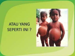 ATAU YANG
SEPERTI INI ?
 