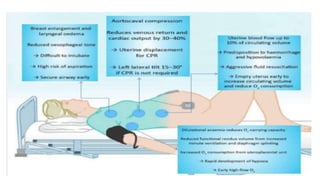 Maternal collapse in pregnancy | PPTX
