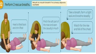 Maternal collapse in pregnancy & puerperium | PPTX