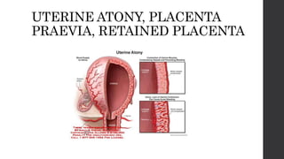 UTERINE ATONY, PLACENTA
PRAEVIA, RETAINED PLACENTA
 