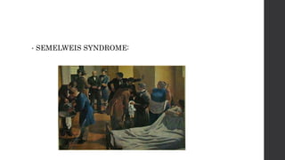 • SEMELWEIS SYNDROME:
 
