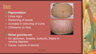 Maternal health 47
Skin
Pigmentation
• Linea nigra
• Darkening of areola
• Increase in colouring of vulva
• Chloasma on face
Striae gravidarum
• On abdomen, breasts, buttocks, thighs in
varying degrees.
• Cause: rupture of dermis
 