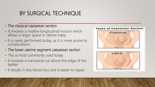 How to Perform Cesarean Section - Evidence Based by Dr KD Dele | PPTX
