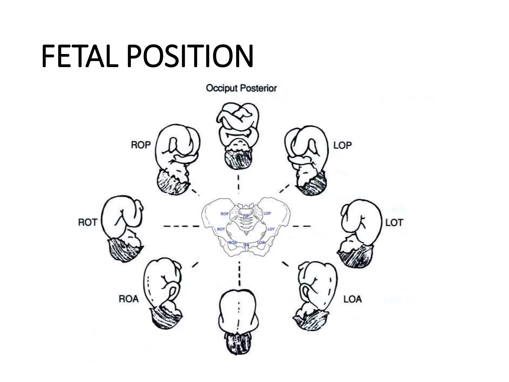 Maternal pelvis and fetal skull | PPTX