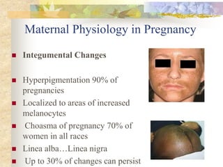 Maternal Physiology in PregnancyIntegumental ChangesHyperpigmentation 90% of pregnancies Localized to areas of increased melanocytes Choasma of pregnancy 70% of women in all racesLinea alba…Linea nigra Up to 30% of changes can persist 