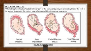 PLACENTA PREVIA –
•Where the placenta attaches to the lower part of the uterus and partly or completely blocks the neck of
the womb. As a result, the mother may suffer vaginal bleeding during pregnancy
FIGURE: PLACENTA OREVIA
 