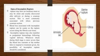 Signs of Incomplete Rupture
 rupture may have an insidious onset or
may be silent and usually discovered
after delivery or during a cesarean
section. This is more commonly
associated with ebrais previous
cesarean section.
 Blood loss associated with incomplete
rupture can be scanty as the rupture
occurs along the fibrous scar tissue.
 Incomplete rupture may also manifest
as postpartum hemorrhage following
vaginal delivery. Whenever shock
during third stage is more severe than
the blood loss warrants or the mother
fails to respond to treatment given, the
possibility of incomplete rupture
should be considered.
 