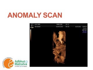 ANOMALY SCAN
 