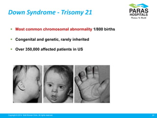 14Copyright © 2014 Well Woman Clinic. All rights reserved.
Down Syndrome - Trisomy 21
 Most common chromosomal abnormality 1/800 births
 Congenital and genetic, rarely inherited
 Over 350,000 affected patients in US
 
