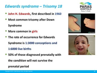 18Copyright © 2014 Well Woman Clinic. All rights reserved.
Edwards syndrome – Trisomy 18
 John H. Edwards, first described in 1960
 Most common trisomy after Down
Syndrome
 More common in girls
 The rate of occurrence for Edwards
Syndrome is 1:3000 conceptions and
1:6000 live births
 50% of those diagnosed prenatally with
the condition will not survive the
prenatal period
 