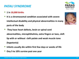 19Copyright © 2014 Well Woman Clinic. All rights reserved.
PATAU SYNDROME
 1 in 10,000 births
 It is a chromosomal condition associated with severe
intellectual disability and physical abnormalities in many
parts of the body
 They have heart defects, brain or spinal cord
abnormalities, microphthalmia, extra fingers or toes, cleft
lip with or without cleft palate and weak muscle tone
(hypotonia)
 Infants usually die within first few days or weeks of life
 Ony 5 to 10% survive past one year
 