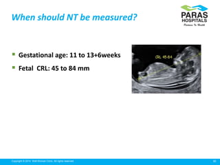 30Copyright © 2014 Well Woman Clinic. All rights reserved.
 Gestational age: 11 to 13+6weeks
 Fetal CRL: 45 to 84 mm
When should NT be measured?
 