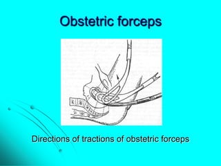 Maternal trauma. obstetric surgeries | PPTX