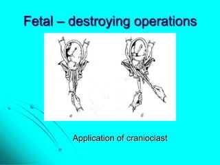 Maternal trauma. obstetric surgeries | PPTX