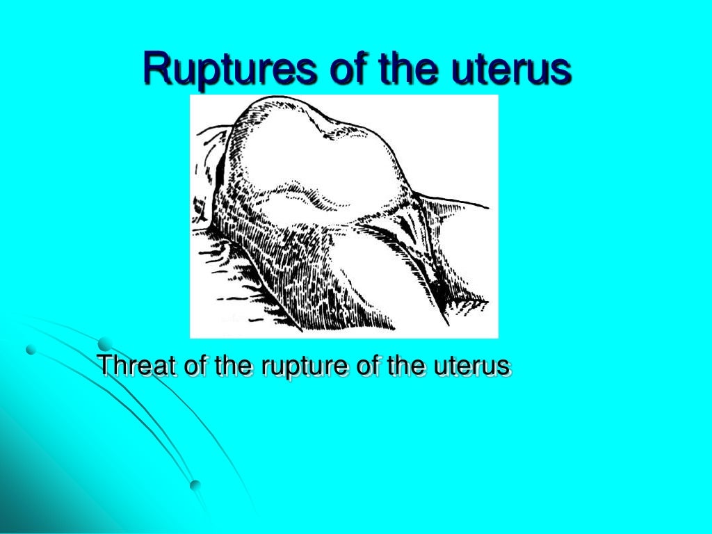 Maternal trauma. obstetric surgeries