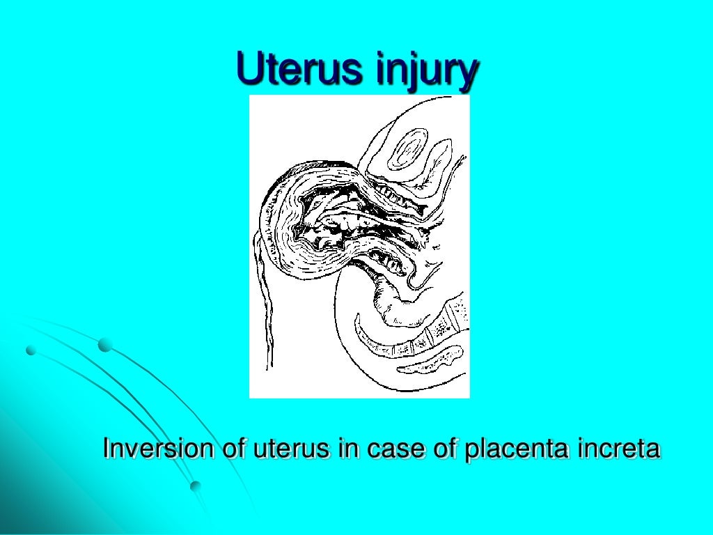 Maternal trauma. obstetric surgeries