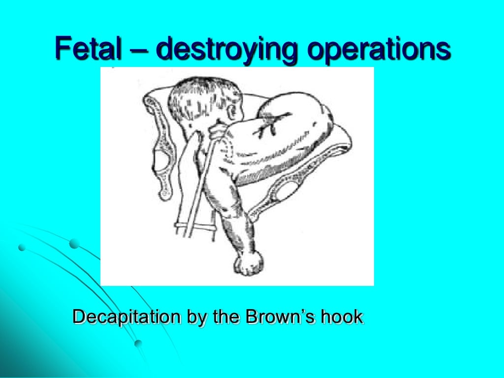 Maternal trauma. obstetric surgeries