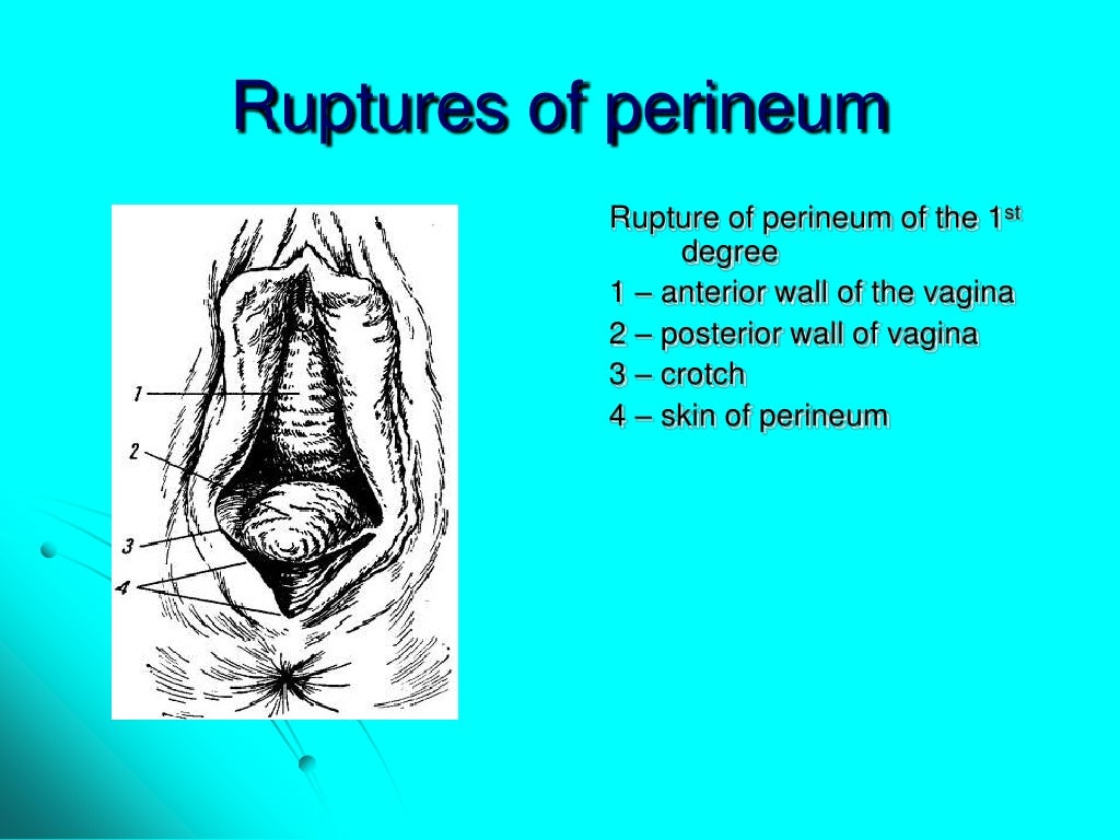 Maternal trauma. obstetric surgeries