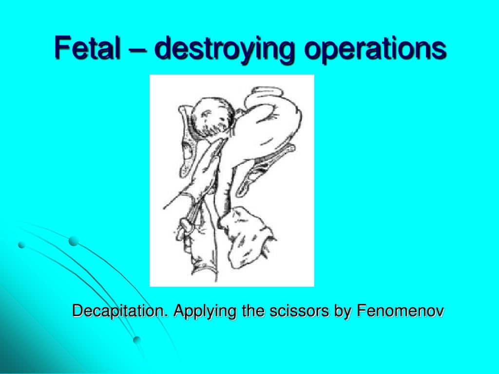 Maternal trauma. obstetric surgeries