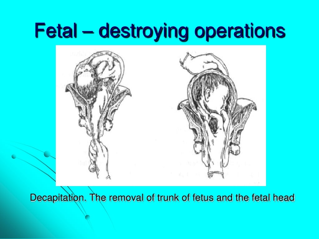Maternal trauma. obstetric surgeries