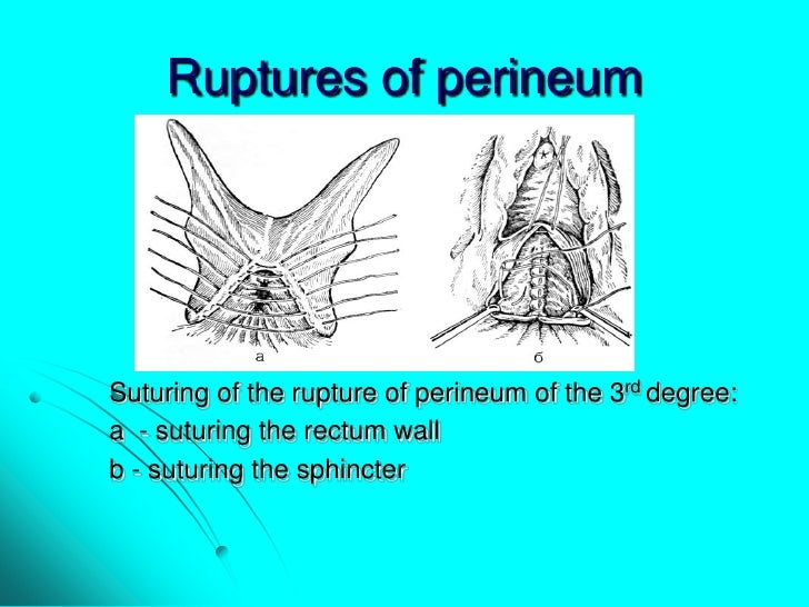 Maternal trauma. obstetric surgeries