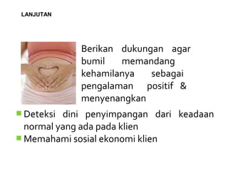 Berikan dukungan agar
bumil memandang
kehamilanya sebagai
pengalaman positif &
menyenangkan
 Deteksi dini penyimpangan dari keadaan
normal yang ada pada klien
 Memahami sosial ekonomi klien
LANJUTAN
 
